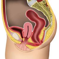 Mild uterine prolapse