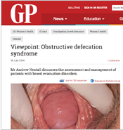 Obstructive defecation syndrome